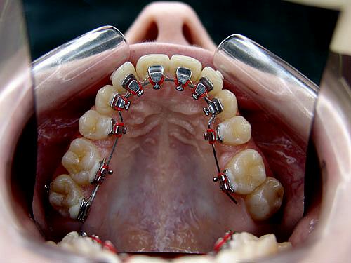   Клиника «ManeClinic» предлагает восстановление зубов любой сложности с применением новейших технологий и качественных материалов. 12100